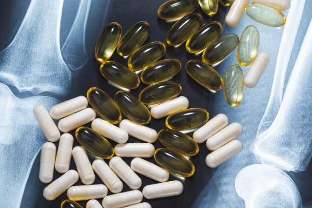 Close-up of X-ray image, fish oil capsules and white pills. Dietary supplements and drugs.